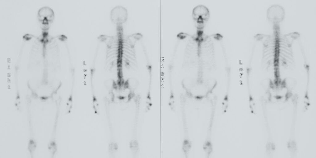 wpis-bodyscan-1024x512.jpg